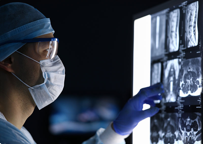 dr. neil cochrane examining an x-ray before brain surgery